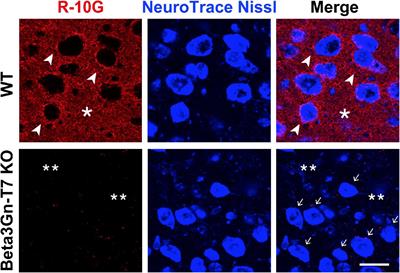 Beta3Gn-T7 Is a Keratan Sulfate β1,3 N-Acetylglucosaminyltransferase in the Adult Brain